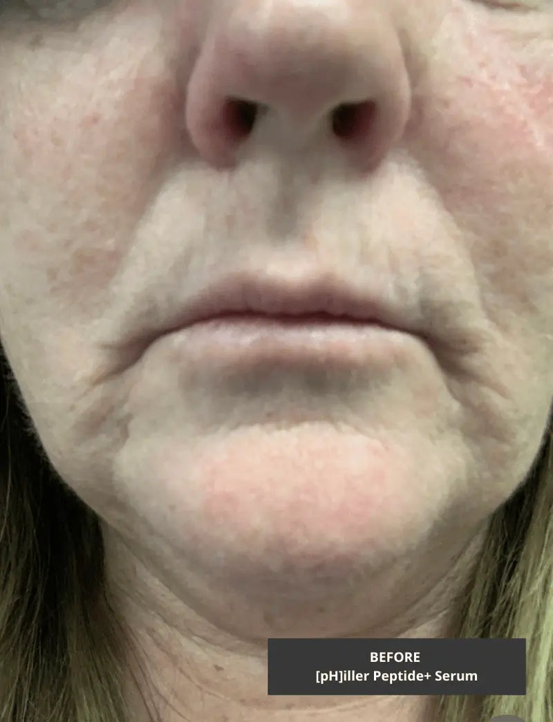 Philler Peptide Serum | Antioxidant Peptides Face Serum for Skincare