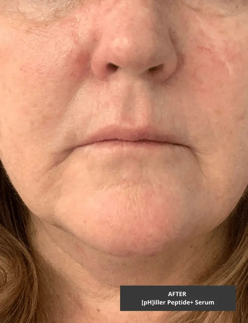 Philler Peptide Serum | Antioxidant Peptides Face Serum for Skincare