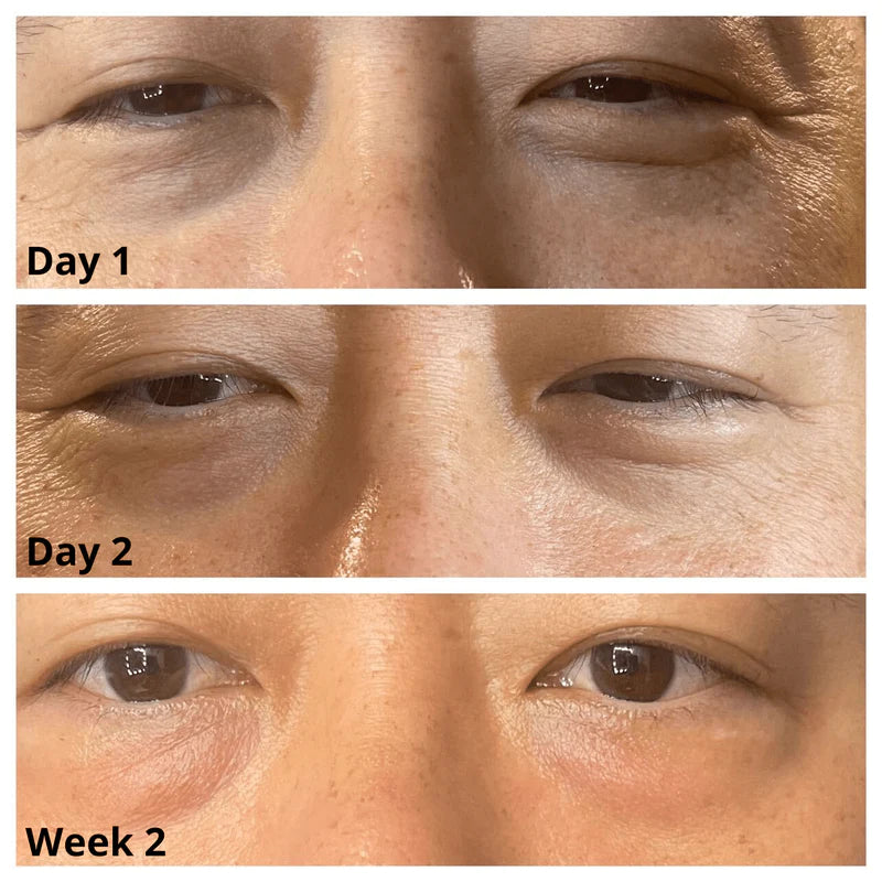 Caffeine Eye Cream for Dark Circles & Puffiness