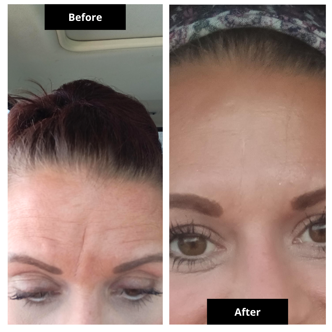 Special Limited Mothers Day Bundle Ultimate Anti Aging Bundle