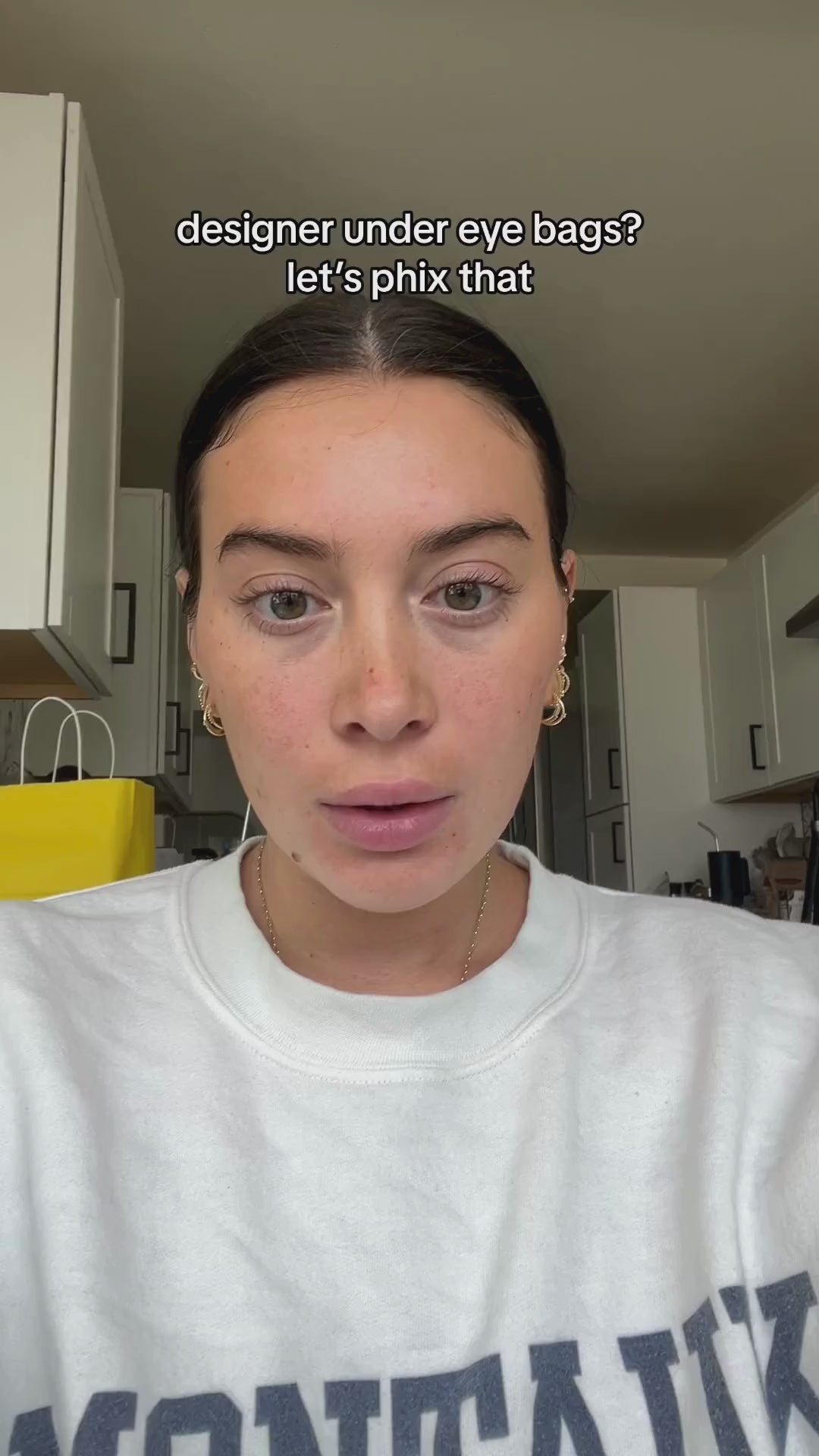 Fix your dark, dry, puffy under eyes with the phix caffeine under eye plumping eye cream