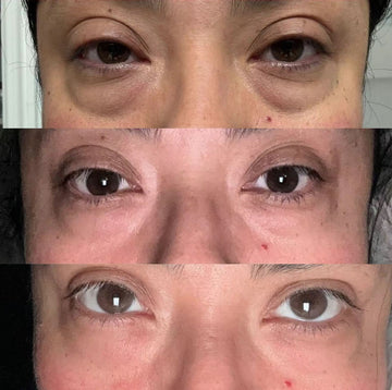Special Limited Mothers Day Bundle Ultimate Anti Aging Bundle
