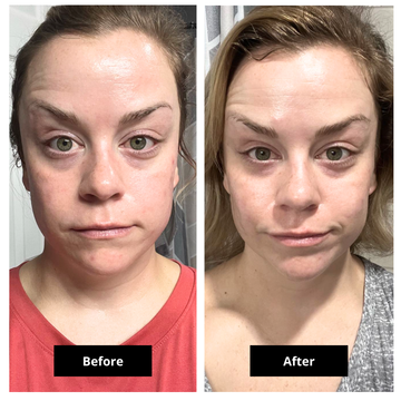 Special Limited Mothers Day Bundle Ultimate Anti Aging Bundle